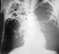 cxr-physician-burnout-symptoms-safety-quality-satisfaction-turnover_opt240W